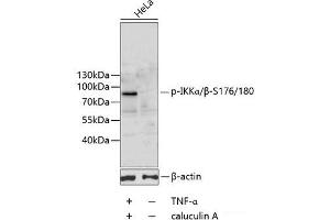 Western blot analysis of extracts of HeLa cells using Phospho-IKKα/β(S176/180) Polyclonal Antibody. (IKK-alpha /IKK-beta 抗体  (pSer176, pSer180))
