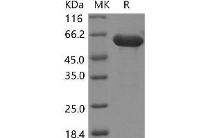 HEXB Protein (His tag)