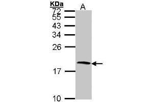 WB Image Sample (30 ug of whole cell lysate) A: Hep G2 , 15% SDS PAGE antibody diluted at 1:1000 (CST4 抗体  (N-Term))