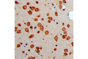 Immunohistochemical analysis of Somatostatin staining in human brain formalin fixed paraffin embedded tissue section. (Somatostatin 抗体  (N-Term))