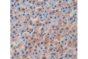 Used in DAB staining on fromalin fixed paraffin- embedded Kidney tissue (ITIH1 抗体  (AA 412-664))