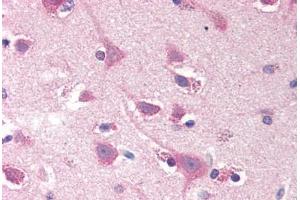Human Brain, Cortex (formalin-fixed, paraffin-embedded) stained with SMOC2 antibody ABIN290277 at 20 ug/ml followed by biotinylated goat anti-rabbit IgG secondary antibody ABIN481713, alkaline phosphatase-streptavidin and chromogen. (SMOC2 抗体  (N-Term))
