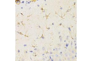 Immunohistochemistry of paraffin-embedded rat brain using KIF1B Antibody. (KIF1B 抗体  (AA 1501-1770))