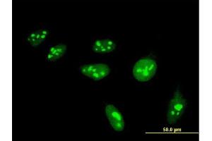 Immunofluorescence of monoclonal antibody to HIST1H4H on HeLa cell. (HIST1H4H 抗体  (AA 31-103))