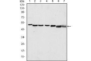 Western blot analysis using p63α mouse mAb against A431 (1), Hela (2), Jurkat (3), THP-1 (4), NIH/3T3 (5), Cos7 (6) and PC-12 (7) cell lysate. (p63alpha 抗体)