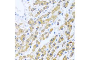 Immunohistochemistry of paraffin-embedded human liver using MANF antibody (ABIN6291535) at dilution of 1:100 (40x lens). (MANF 抗体)