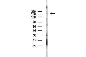 anti-Centrosomal Protein 170kDa (CEP170) (Internal Region) antibody