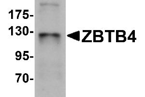 Western Blotting (WB) image for anti-Zinc Finger and BTB Domain Containing 4 (ZBTB4) (C-Term) antibody (ABIN1030812) (ZBTB4 抗体  (C-Term))