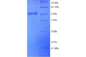 SDS-PAGE (SDS) image for Adenosine Deaminase, RNA-Specific (ADAR) (AA 1-176), (partial) protein (GST tag) (ABIN5712083)