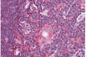 Immunohistochemistry (Formalin-fixed Paraffin-embedded Sections) (IHC (fp)) image for anti-Gem (Nuclear Organelle) Associated Protein 2 (GEMIN2) (C-Term) antibody (ABIN625932)