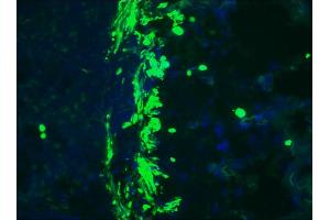 Image no. 2 for anti-Desmin (DES) antibody (ABIN335360) (Desmin 抗体)