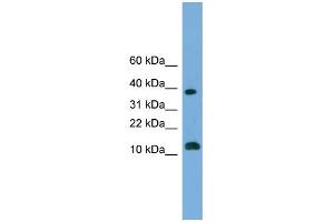 WB Suggested Anti-LOC152586 Antibody Titration: 0. (GL54D 抗体  (Middle Region))