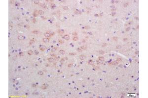 Formalin-fixed and paraffin embedded rat brain labeled with Rabbit Anti Phospho-NMDAR1(Ser890) Polyclonal Antibody, Unconjugated (ABIN744278) at 1:200 followed by conjugation to the secondary antibody and DAB staining (GRIN1/NMDAR1 抗体  (pSer890))