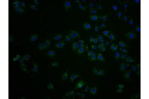 Immunofluorescence staining of A549 cells with ABIN7143977 at 1:100, counter-stained with DAPI. (SCNN1D 抗体  (AA 292-519))