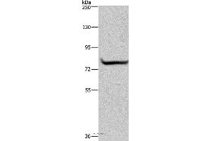 Western blot analysis of 293T cell, using GYS1 Polyclonal Antibody at dilution of 1:300 (Glycogen Synthase 1 抗体)