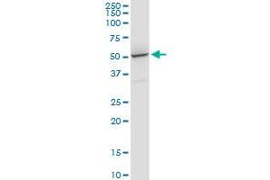PRPF31 monoclonal antibody (M02), clone 8E1. (PRPF31 抗体  (AA 400-499))