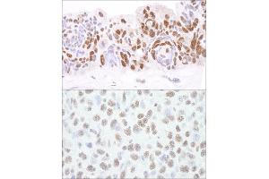 Immunohistochemistry (IHC) image for anti-Histone Deacetylase 1 (HDAC1) (C-Term) antibody (ABIN7454668)