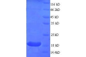 Myosin, Light Chain 2, Regulatory, Cardiac, Slow (MYL2) (AA 8-164), (partial) protein (His tag) (MYL2 Protein (AA 8-164, partial) (His tag))