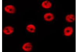 ABIN6274006 staining Hela by IF/ICC. (DGCR8 抗体  (C-Term))