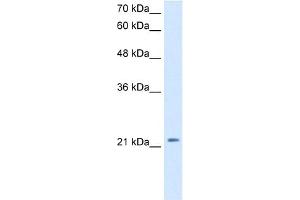 WB Suggested Anti-DKK1 Antibody Titration:  2. (DKK1 抗体  (C-Term))