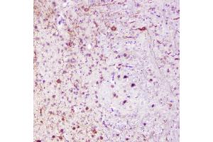 IHC analysis of Calbindin using anti-Calbindin antibody (ABIN6719541). (CALB1 抗体  (AA 2-261))