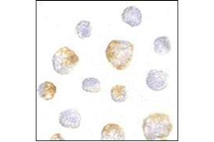Immunocytochemistry of KIF5 in K562 cells with this product at 5 μg/ml. (KIF5A 抗体  (Center))