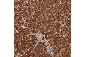 Immunohistochemical staining of human liver with SH2D4A polyclonal antibody  shows strong cytoplasmic positivity in hepatocytes at 1:50-1:200 dilution. (SH2D4A 抗体)