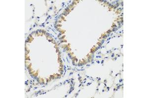 Immunohistochemistry of paraffin-embedded mouse lung using VEGFR3/FLT4 antibody (ABIN6130780, ABIN6140699, ABIN6140702 and ABIN6221242) at dilution of 1:200 (40x lens). (FLT4 抗体  (AA 1174-1363))