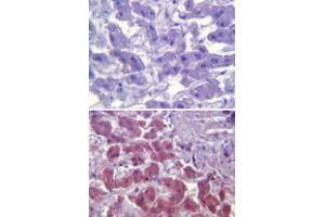 Immunohistochemical analysis of TLR6 in paraffin-embedded formalin-fixed human liver tissue using an isotype control (top) and TLR6 monoclonal antibody, clone 86B1153. (TLR6 抗体  (AA 408-424))