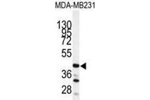 Image no. 1 for anti-Cathepsin S (CTSS) (Middle Region) antibody (ABIN452893) (Cathepsin S 抗体  (Middle Region))
