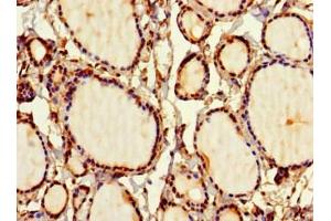 Immunohistochemistry of paraffin-embedded human thyroid tissue using ABIN7169707 at dilution of 1:100 (SIRPB1 抗体  (AA 30-371))