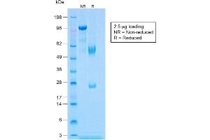 SDS-PAGE Analysis of Purified Calponin Rabbit Recombinant Monoclonal Antibody (CNN1/1408R). (Recombinant CNN1 抗体)