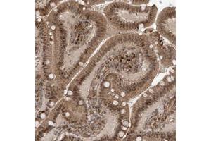 Immunohistochemical staining of human duodenum with ATAD2B polyclonal antibody  shows moderate cytoplasmic and nuclear positivity in glandular cells at 1:50-1:200 dilution. (ATAD2B 抗体)