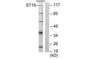 Western blot analysis of extracts from HUVEC cells, using ZNF387 antibody. (ST18 抗体  (N-Term))
