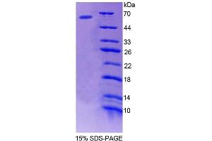 SDS-PAGE analysis of Human bACE1 Protein. (BACE1 蛋白)