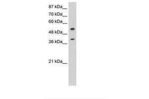 Image no. 3 for anti-NOBOX Oogenesis Homeobox (NOBOX) (AA 37-86) antibody (ABIN6736252) (NOBOX 抗体  (AA 37-86))
