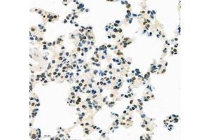 Immunohistochemistry (Paraffin-embedded Sections) (IHC (p)) image for anti-TEA Domain Family Member 3 (TEAD3) antibody (ABIN7075852)