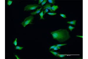 Immunofluorescence of purified MaxPab antibody to DGCR8 on HeLa cell. (DGCR8 抗体  (AA 1-773))