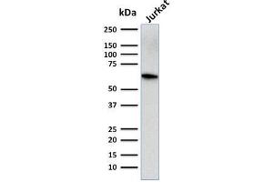 Western Blot Analysis of human Jurkat cell lysate using CD5-Monospecific Mouse Monoclonal Antibody (CD5/2416). (CD5 抗体  (AA 269-366))