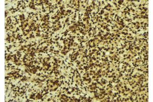 Immunohistochemistry (IHC) image for anti-General Transcription Factor IIH, Polypeptide 1, 62kDa (GTF2H1) (N-Term) antibody (ABIN6256996)