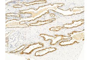 ABIN7094817 and ABIN7098868 at 1/100 staining Mouse heart tissue by IHC-P.