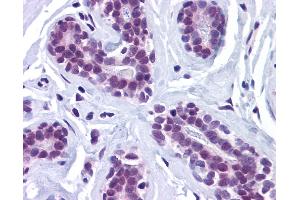 Anti-RBBP8 / CTIP antibody IHC of human breast. (Retinoblastoma Binding Protein 8 抗体  (Internal Region))