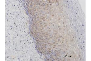 Immunoperoxidase of purified MaxPab antibody to RPL29 on formalin-fixed paraffin-embeddedhuman uterine cervix. (RPL29 抗体  (AA 1-159))