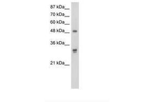 Image no. 1 for anti-DEAD (Asp-Glu-Ala-As) Box Polypeptide 19B (DDX19B) (AA 382-431) antibody (ABIN203175) (DDX19B 抗体  (AA 382-431))