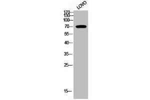 Western Blot analysis of LOVO cells using Phospho-p70 S6 kinase α (T229) Polyclonal Antibody