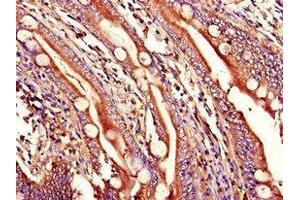Immunohistochemistry of paraffin-embedded human small intestine tissue using ABIN7166507 at dilution of 1:100
