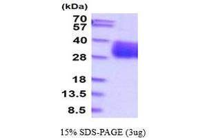 SDS-PAGE (SDS) image for Retinoic Acid Early Transcript 1E (RAET1E) (AA 29-227) protein (His tag) (ABIN5854722) (Retinoic Acid Early Transcript 1E (RAET1E) (AA 29-227) protein (His tag))