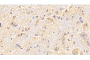 Immunohistochemistry (IHC) image for anti-Secretagogin, EF-Hand Calcium Binding Protein (SCGN) (AA 1-276) antibody (ABIN7436366)