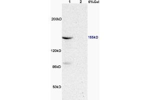 L1 rat heart, L2 rat brain lysates probed (ABIN683128) at 1:200 in 4 °C. (ASK1 抗体  (pThr845))