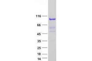 Western Blotting (WB) image for Nuclear Cap Binding Protein Subunit 1, 80kDa (NCBP1) protein (Myc-DYKDDDDK Tag) (ABIN2726875)
